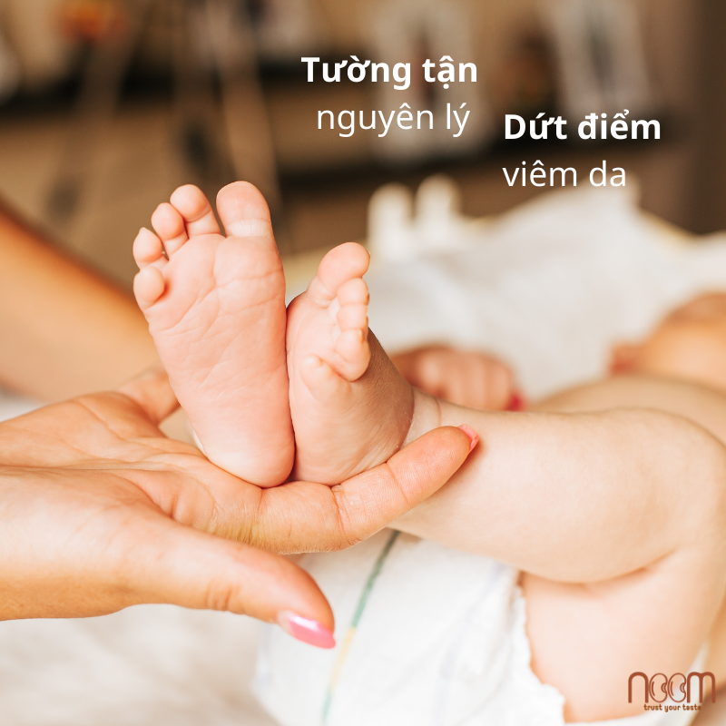 Lối Thoát Nào Cho Viêm Da Cơ Địa Ở Trẻ Em