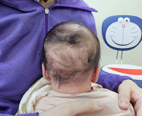 Thiếu canxi rất nguy hiểm, bổ sung sai nguy hiểm hơn