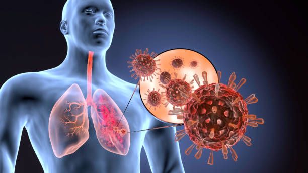 Virus RSV là gì? Tìm hiểu quá trình lây nhiễm, thời gian ủ bệnh và cách phòng ngừa.