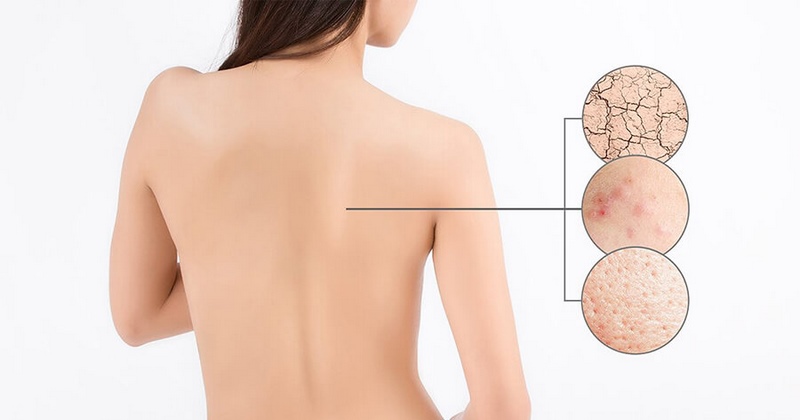 Tẩy Da Chết Đều Đặn - Hãy Chăm Sóc Cơ Thể Của Bạn Đúng Cách