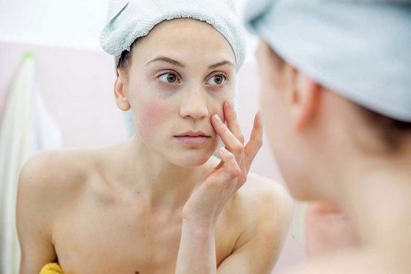 Cách chăm sóc da mặt bị dị ứng rất dễ dàng