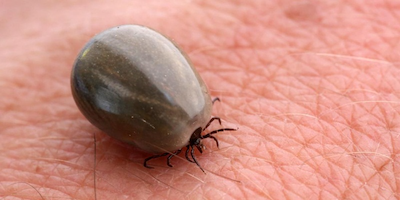 Bệnh Lyme