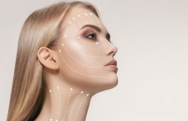 Căng chỉ collagen là gì? Có an toàn không?