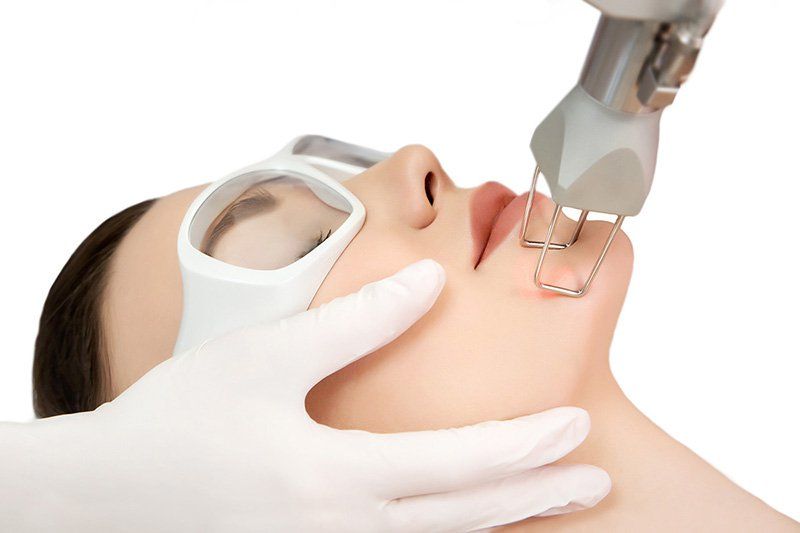 Ưu & nhược điểm của Laser CO2 Fractional trong điều trị sẹo?