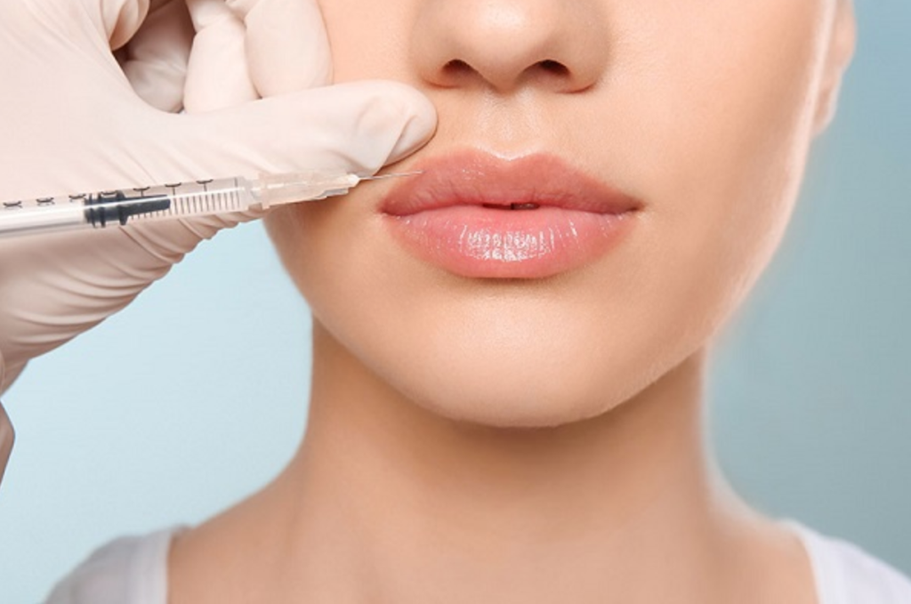 Tiêm filer là gì? Ưu điểm và nhược điểm