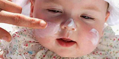 Viêm da cơ địa trẻ em - những điều cha mẹ nên biết