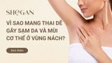 Vì sao mang thai dễ bị sạm da và có mùi cơ thể ở vùng nách?
