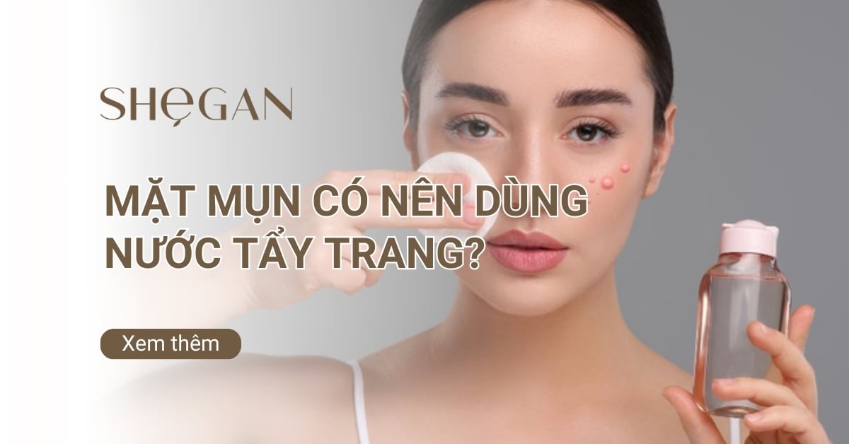 Mặt mụn có nên dùng nước tẩy trang? Cách tẩy trang an toàn