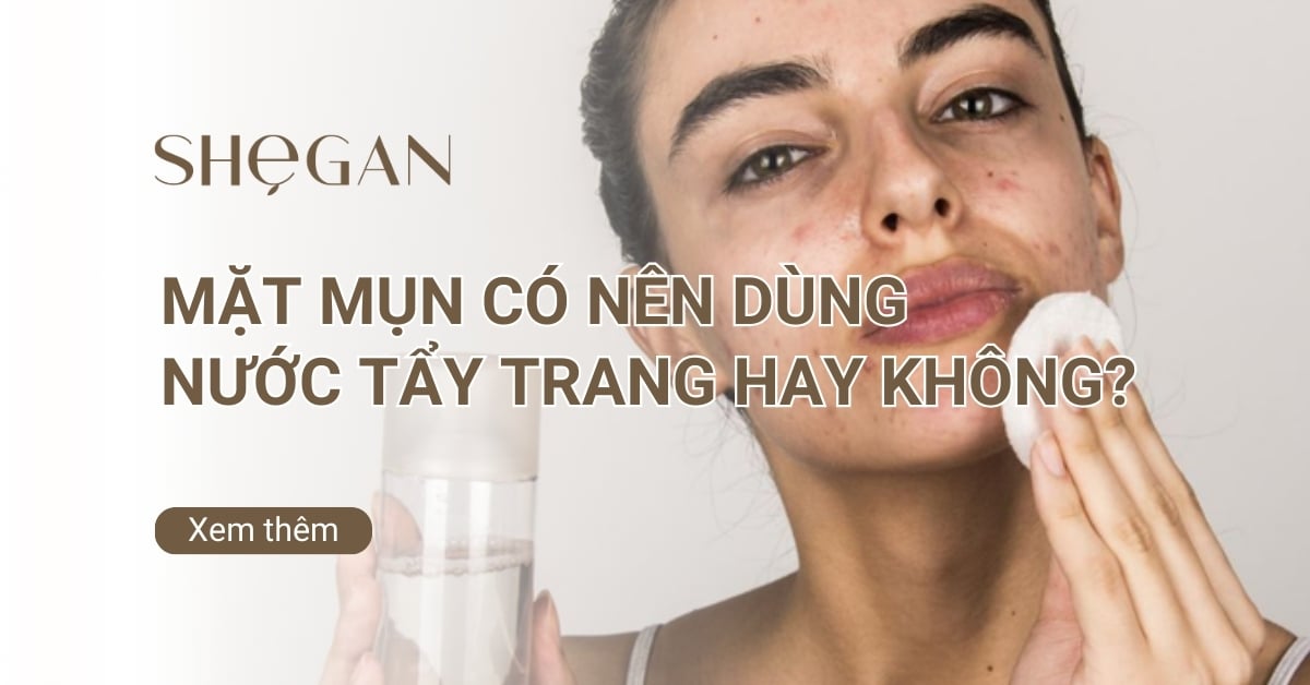 Mặt mụn có nên dùng nước tẩy trang hay không?