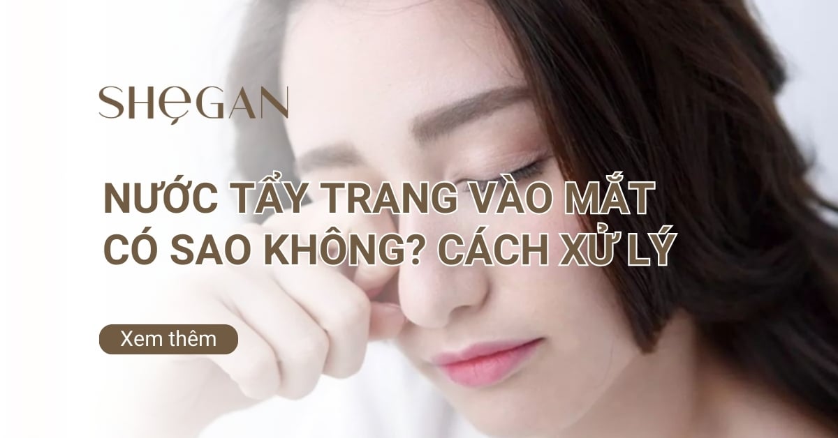 Nước tẩy trang vào mắt có sao không? Cách xử lý nhanh chóng