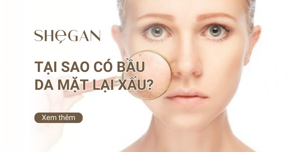 Tại sao có bầu da mặt lại xấu? Các tiêu chí và Cách chăm sóc