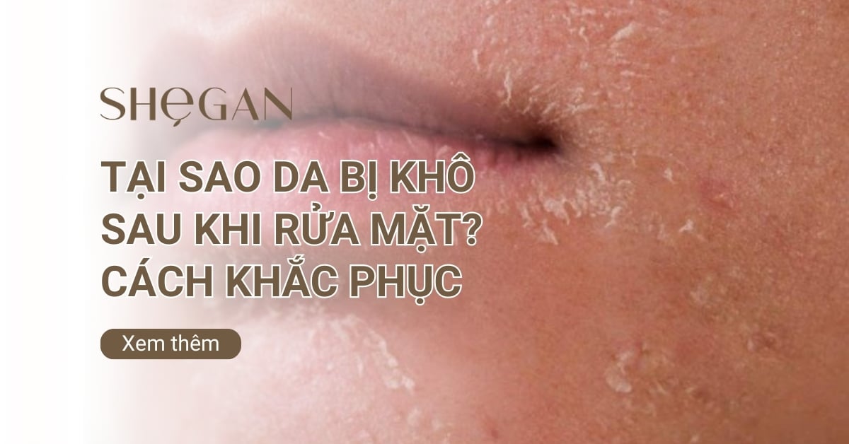 Tại sao da bị khô sau khi rửa mặt? Cách khắc phục hiệu quả