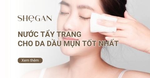 Top 10 nước tẩy trang cho da dầu mụn tốt nhất hiện nay