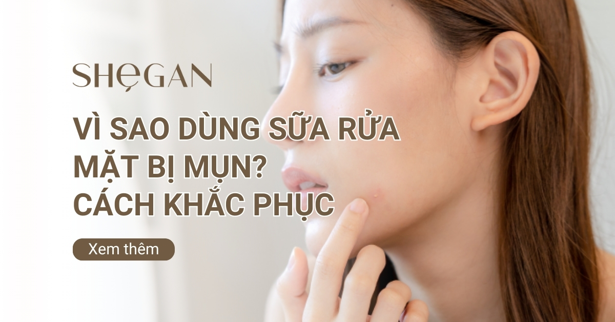 Vì sao dùng sữa rửa mặt bị mụn? 7 cách khắc phục phổ biến