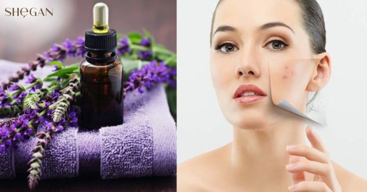 tinh dầu oải hương trị thâm mụn