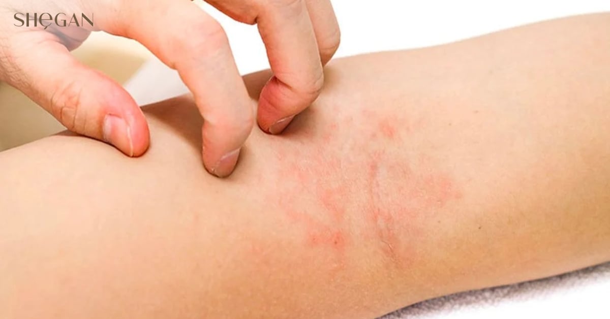 Làm dịu và chống viêm