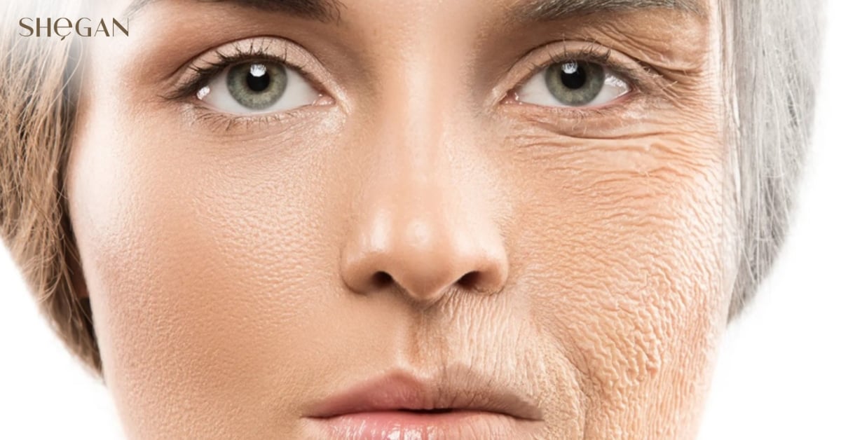 Giảm các dấu hiệu lão hóa