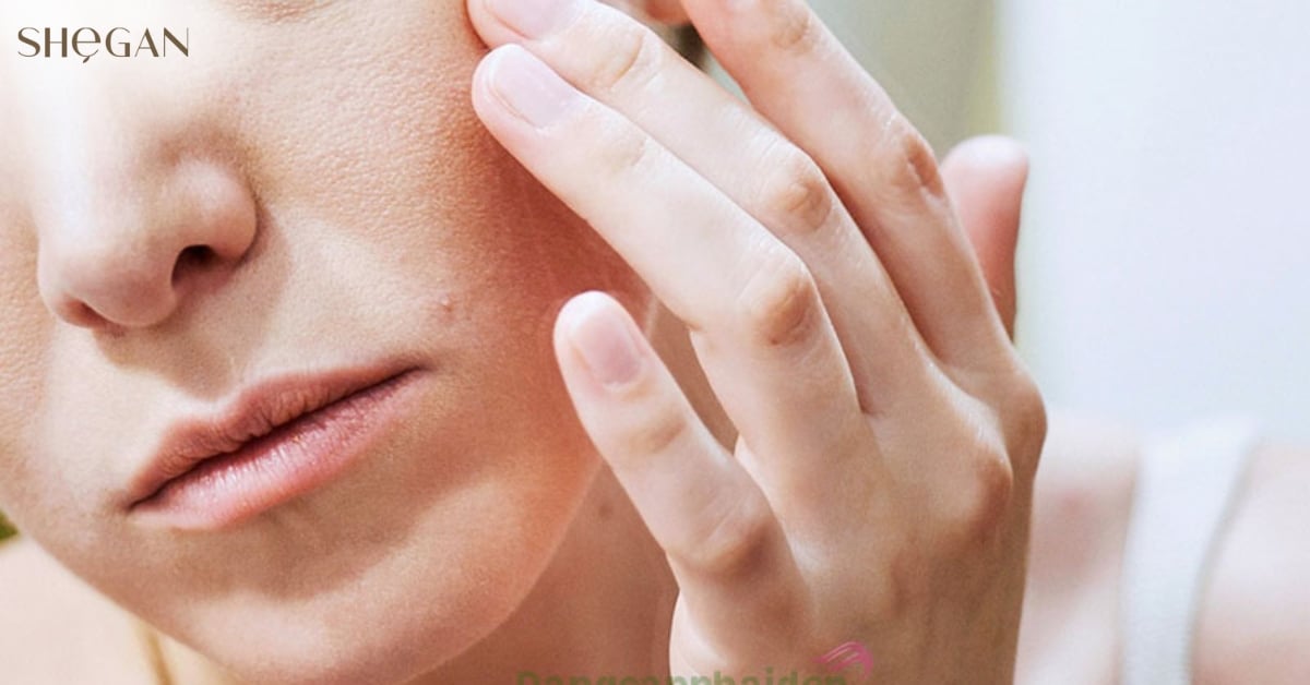 Da bị khô sau khi rửa mặt