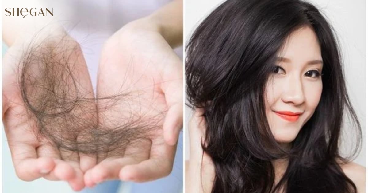 Hỗ trợ làm giảm rụng tóc