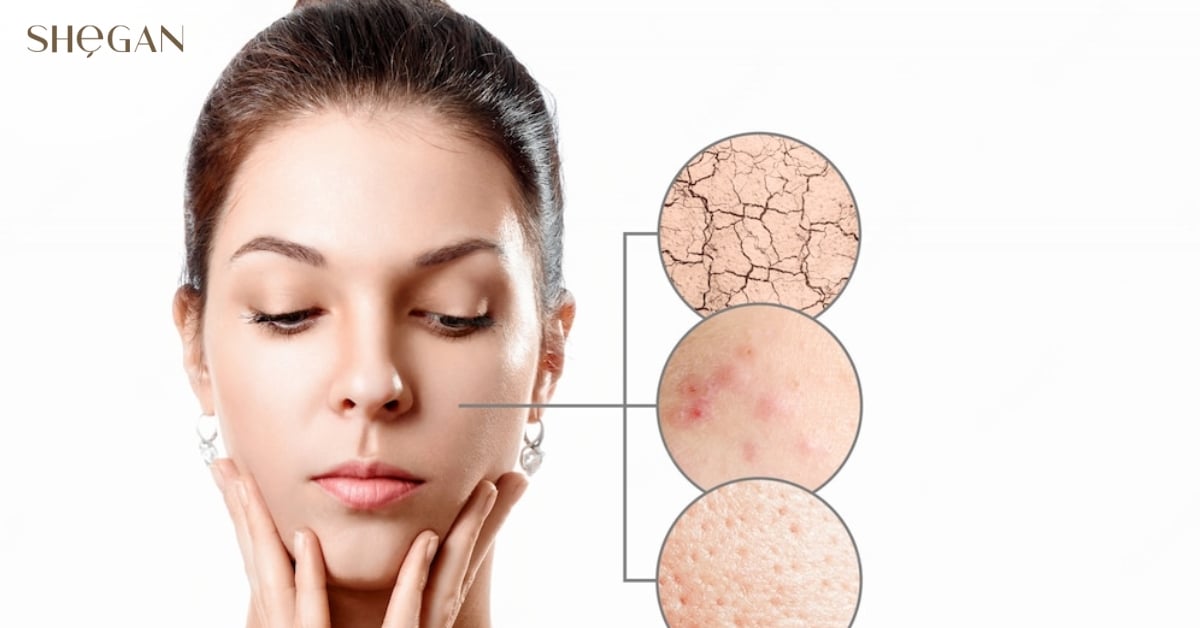 Hỗ trợ điều trị vấn đề da