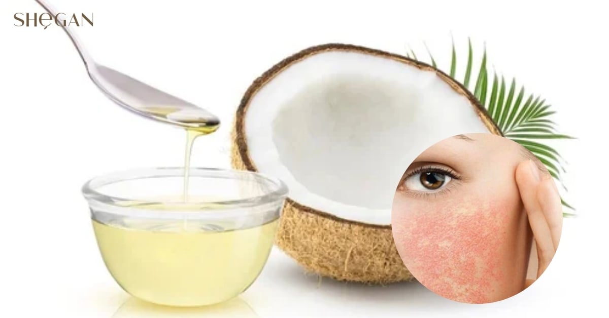 Lưu ý khi sử dụng sản phẩm chứa Cocamidopropyl betaine