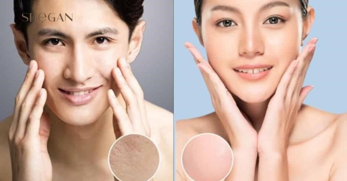 Da mặt nam và nữ khác nhau như thế nào