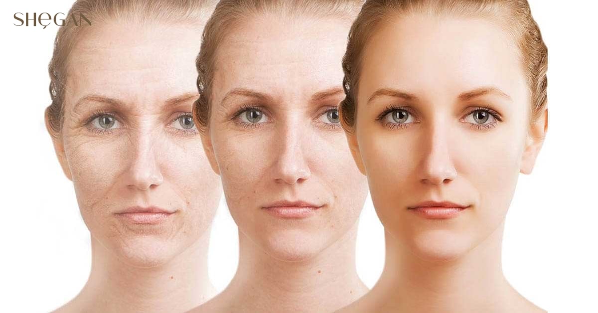 Chống lão hóa, làm mờ nếp nhăn