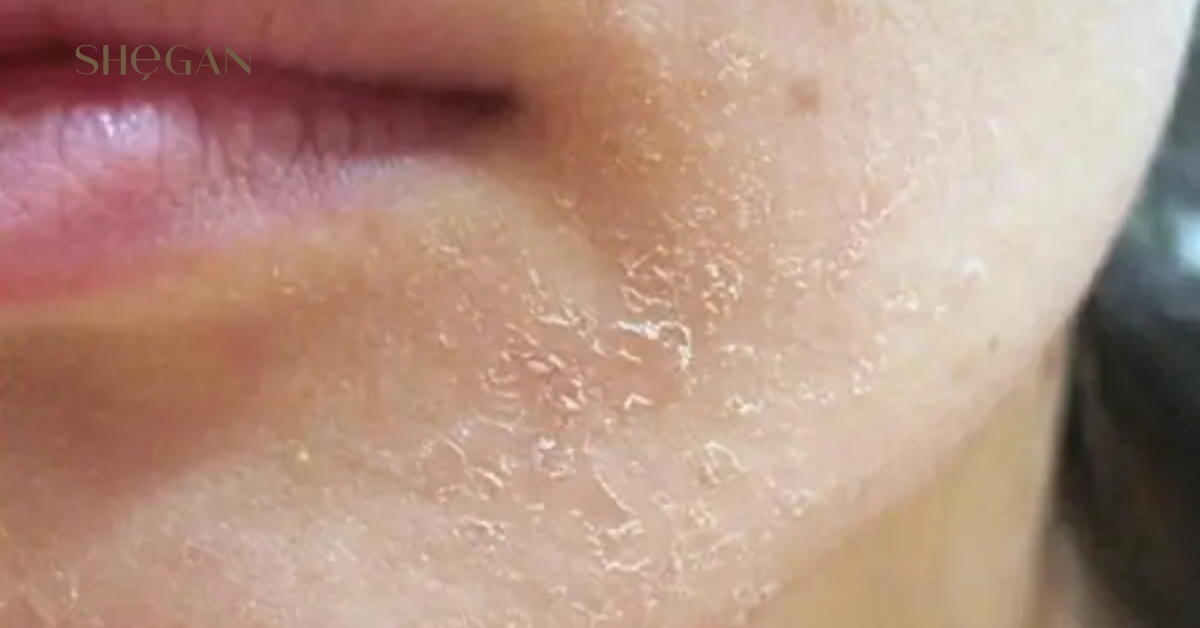 Mùa đông có nên dùng sữa rửa mặt không