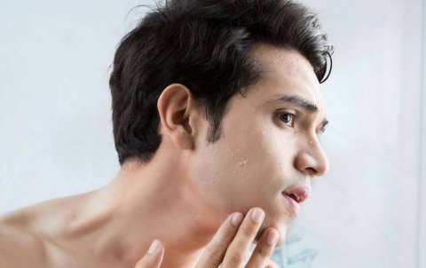 5 nguyên tắc vàng nam giới cần nhớ khi chăm sóc da mụn