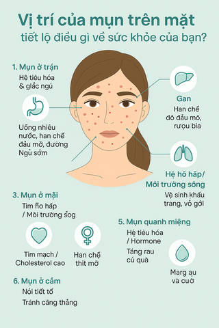 Vị trí của mụn trên mặt tiết lộ điều gì về sức khỏe của bạn?