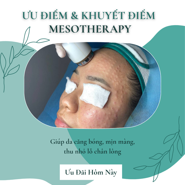 🤔 ƯU VÀ KHUYẾT ĐIỂM CỦA MESOTHERAPY 🤔