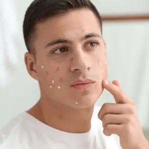 Da mặt đột nhiên nổi nhiều mụn, anh em phải làm sao?