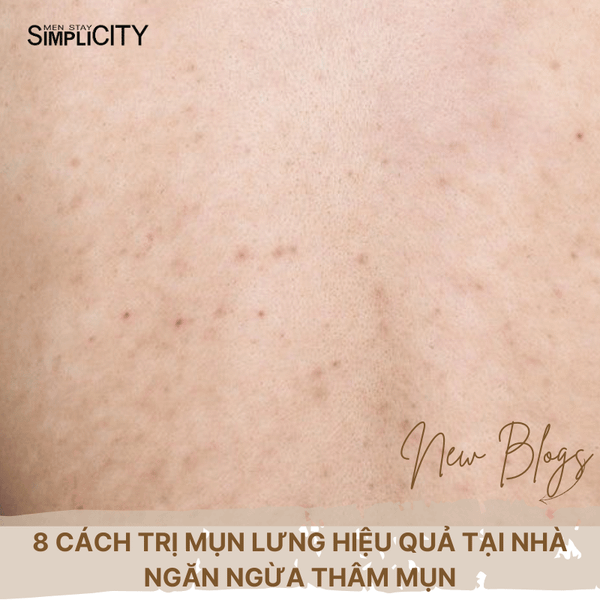8 cách trị mụn lưng hiệu quả tại nhà ngăn ngừa thâm mụn
