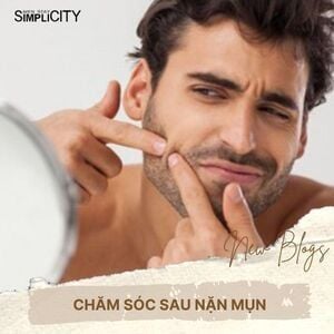 Bí quyết chăm sóc sau nặn mụn mà ai cũng nên biết