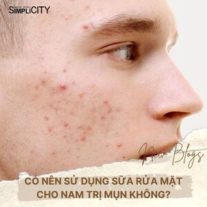 Có nên sử dụng sữa rửa mặt cho nam trị mụn không?