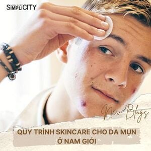 Quy trình skincare đúng cách cho nam giới bị mụn hiệu quả từ A đến Z