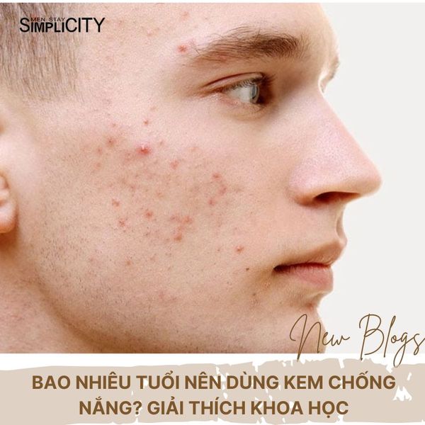 Top các loại serum trị mụn tuổi dậy thì an toàn và hiệu quả