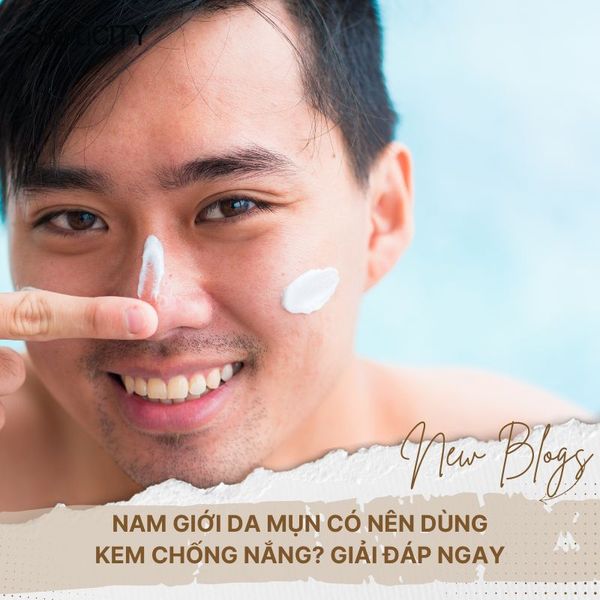 Nam giới da mụn có nên dùng kem chống nắng? Giải đáp ngay