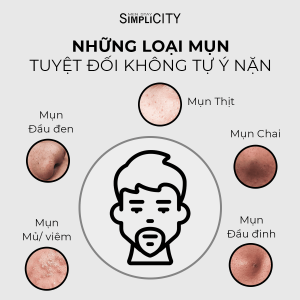 Những loại mụn tuyệt đối không tự ý nặn