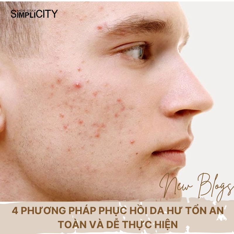 4 phương pháp phục hồi da hư tổn an toàn và dễ thực hiện