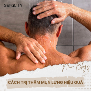 Tổng hợp 5 cách trị thâm mụn lưng cho nam giới hiệu quả