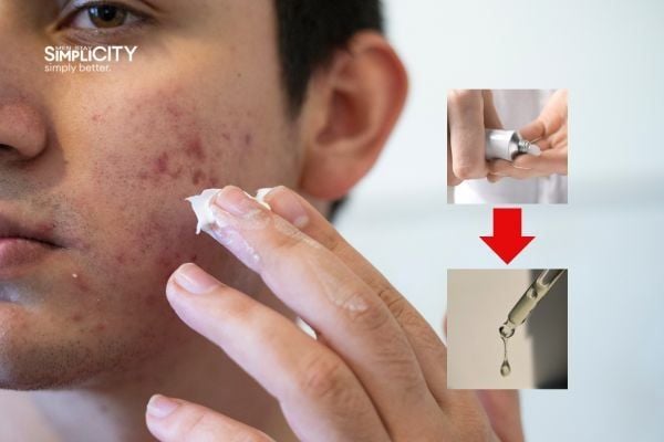 Thoa serum bao lâu thì thoa kem trị mụn - Hướng dẫn hiệu quả