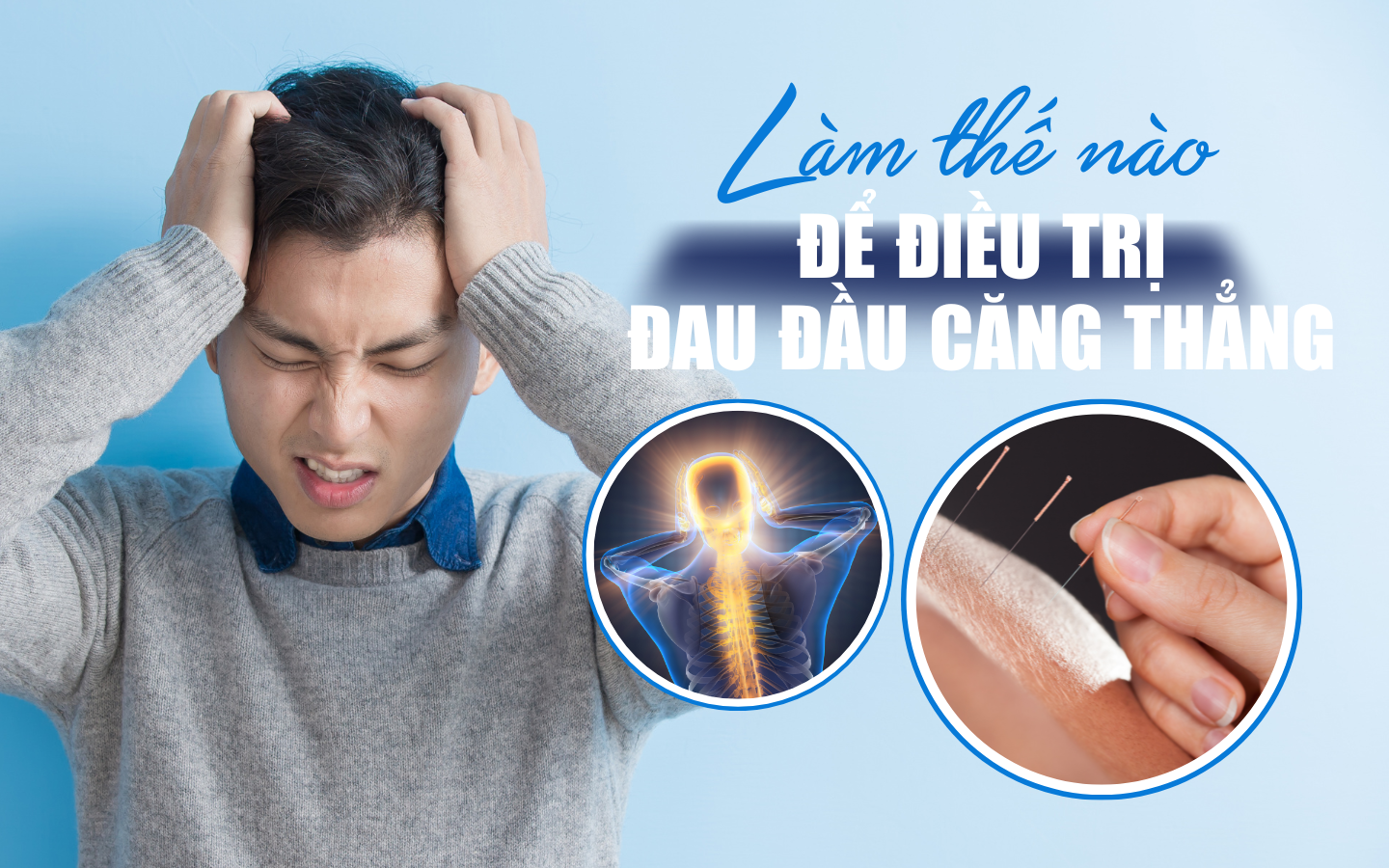 Đau Đầu Do Căng Thẳng: Nhận Biết Nguyên Nhân và Cách Điều Trị Hiệu Quả Nhất Đau Đầu Do Căng Thẳng: Nhận Biết Nguyên Nhân và Cách Điều Trị Hiệu Quả Nhất