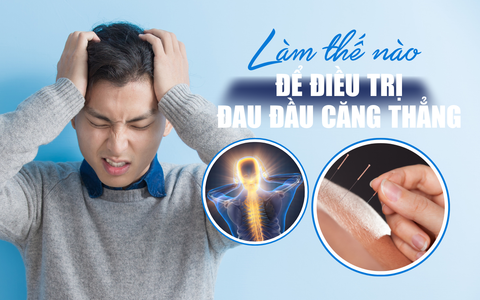 Đau Đầu Do Căng Thẳng: Nhận Biết Nguyên Nhân và Cách Điều Trị Hiệu Quả Nhất