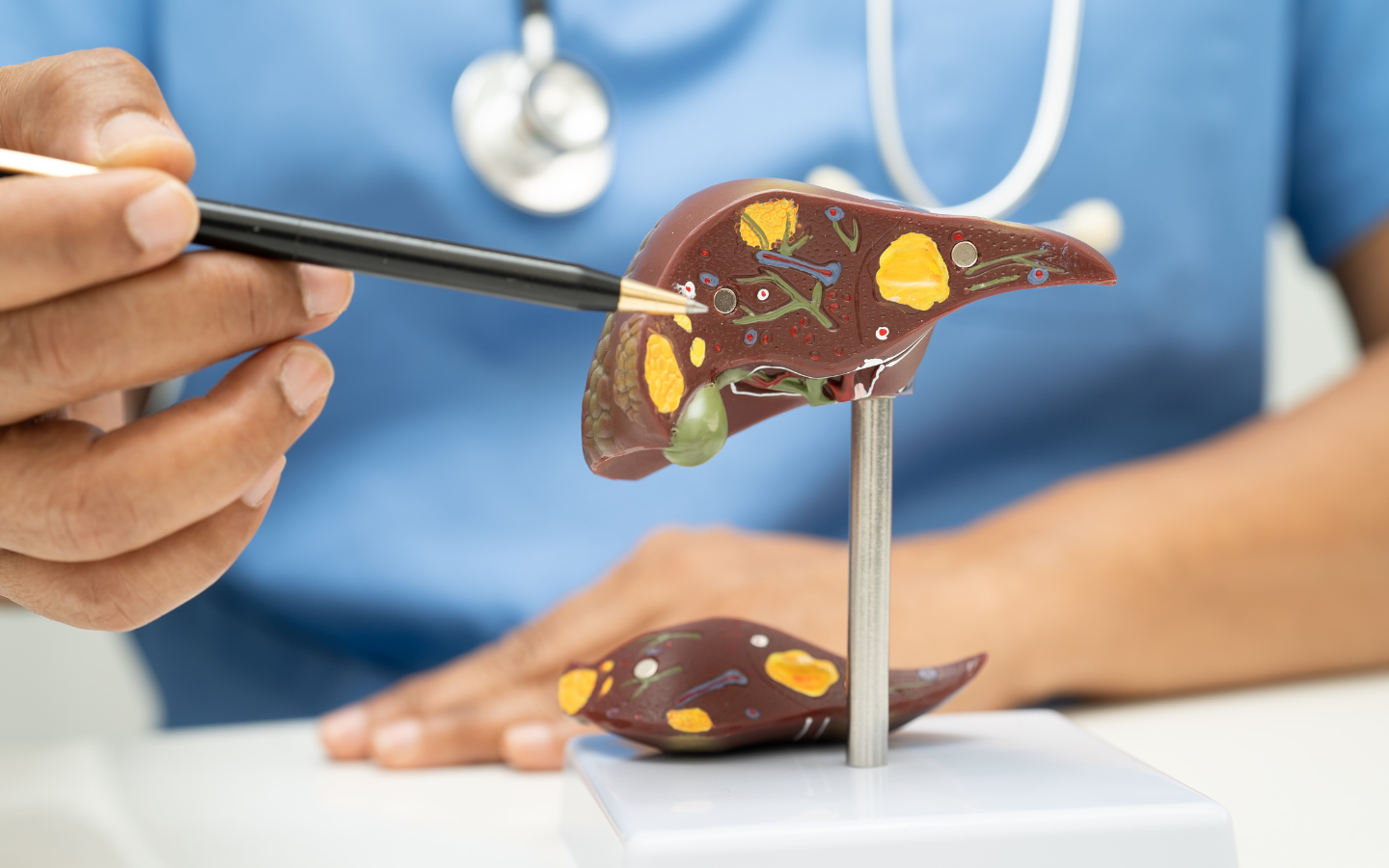 Bảo vệ lá gan: Danh sách thực phẩm 