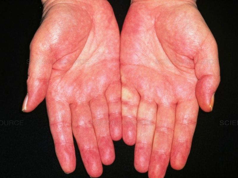 khi-nao-can-thai-doc-gan