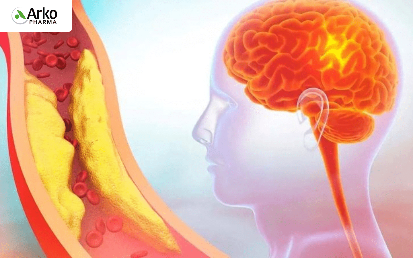 thieu-mau-nao-nen-lam-gì