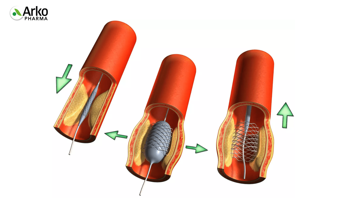 dieu-tri-y-khoa-thieu-mau-nao