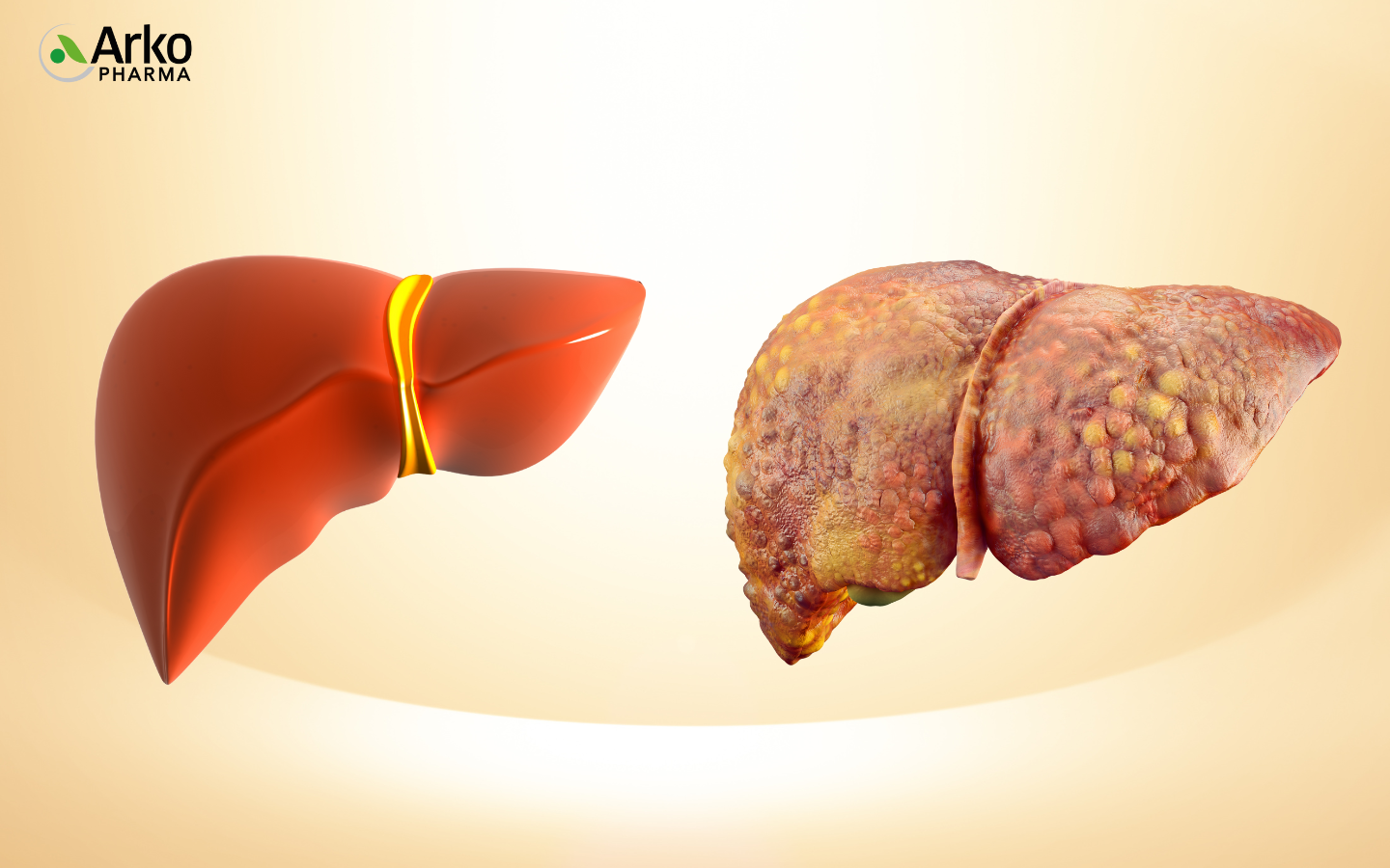 cac-thuc-pham-tot-cho-gan