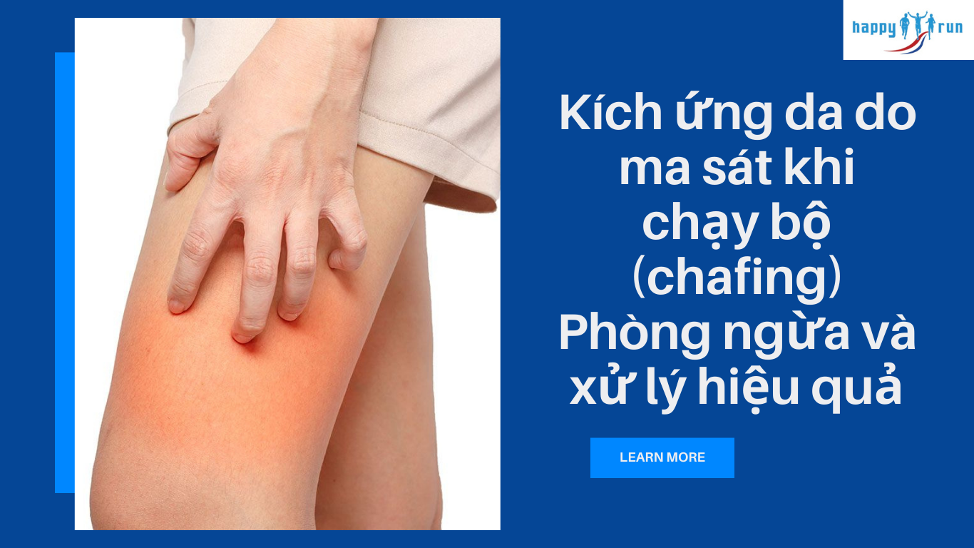 Kích ứng da do ma sát khi chạy bộ (chafing): Phòng ngừa và xử lý hiệu quả